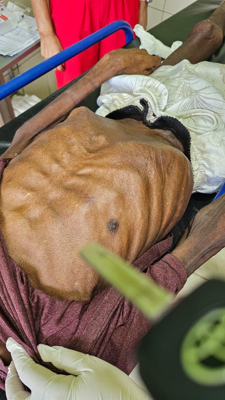 Filha é presa após morte do pai com sinais de maus-tratos e desnutrição em Ipixuna do Pará