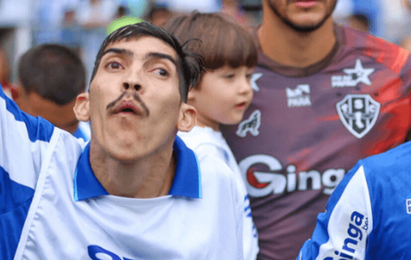 Daniel "Pampam" tem dentes quebrados e sofre lesões profundas no rosto após atropelamento em Belém