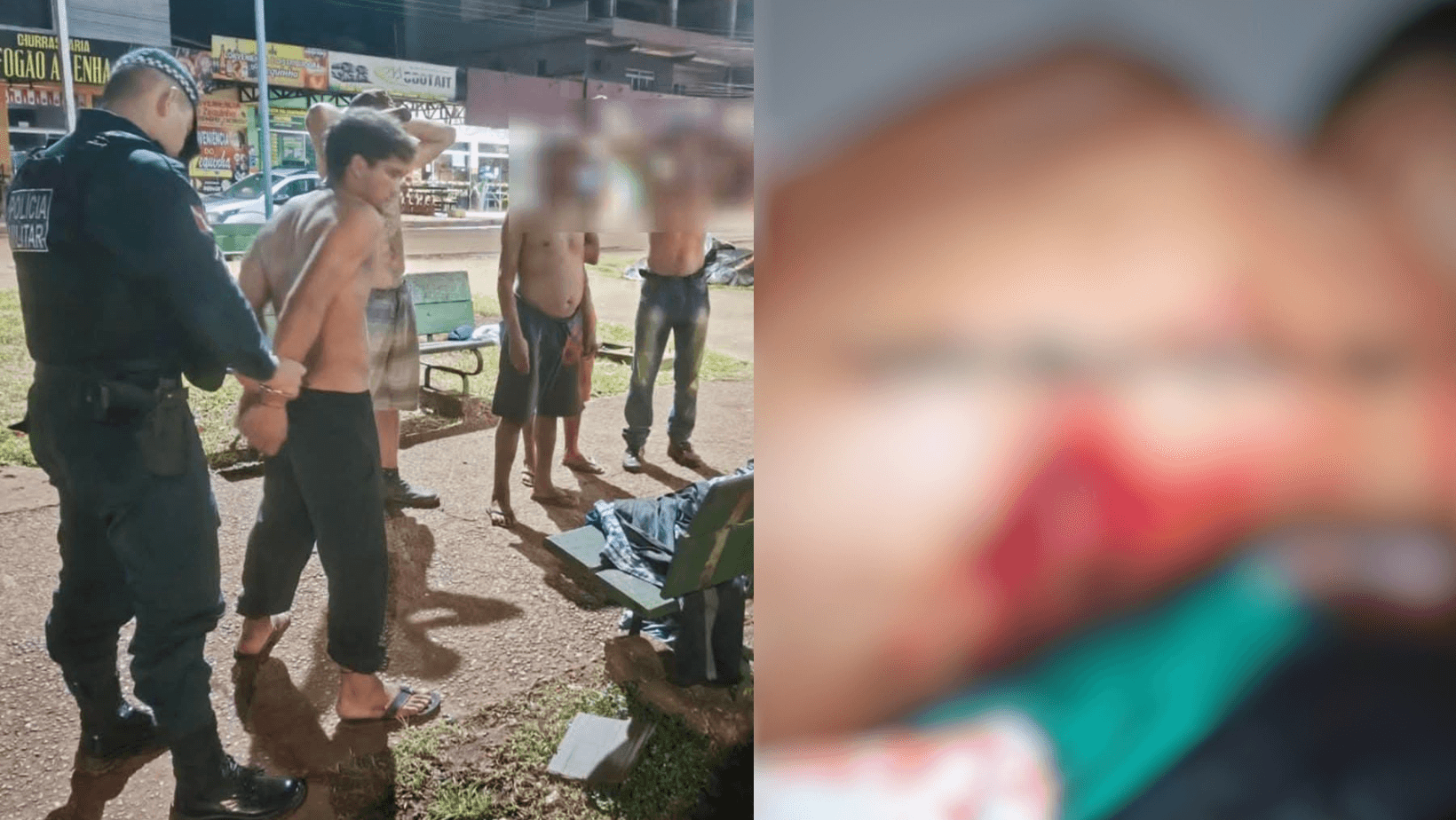 Em Medicilândia, jovem é atacado com gargalo de garrafa e leva 43 pontos 