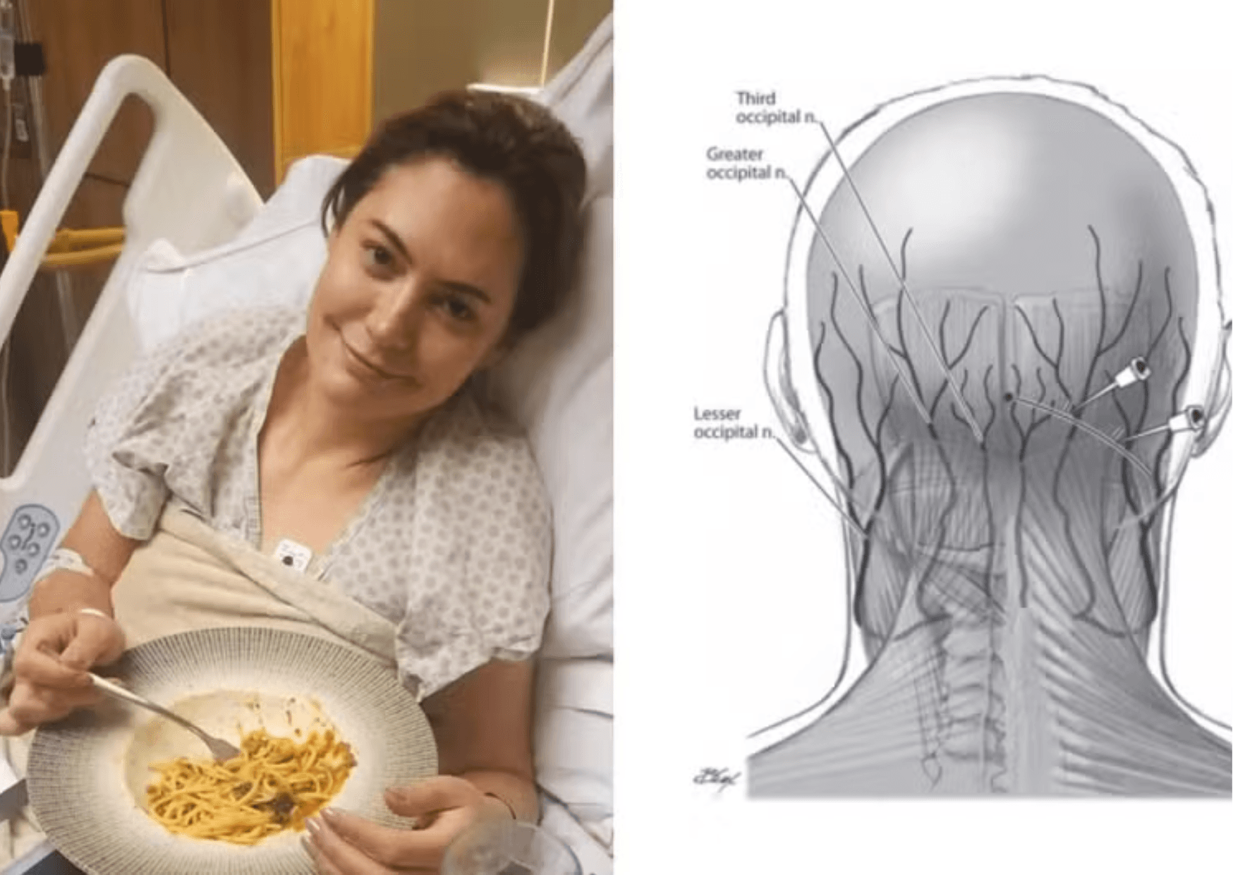 Michelle Bolsonaro: o que é o bloqueio anestésico dos nervos cranianos, procedimento feito pela ex-primeira-dama