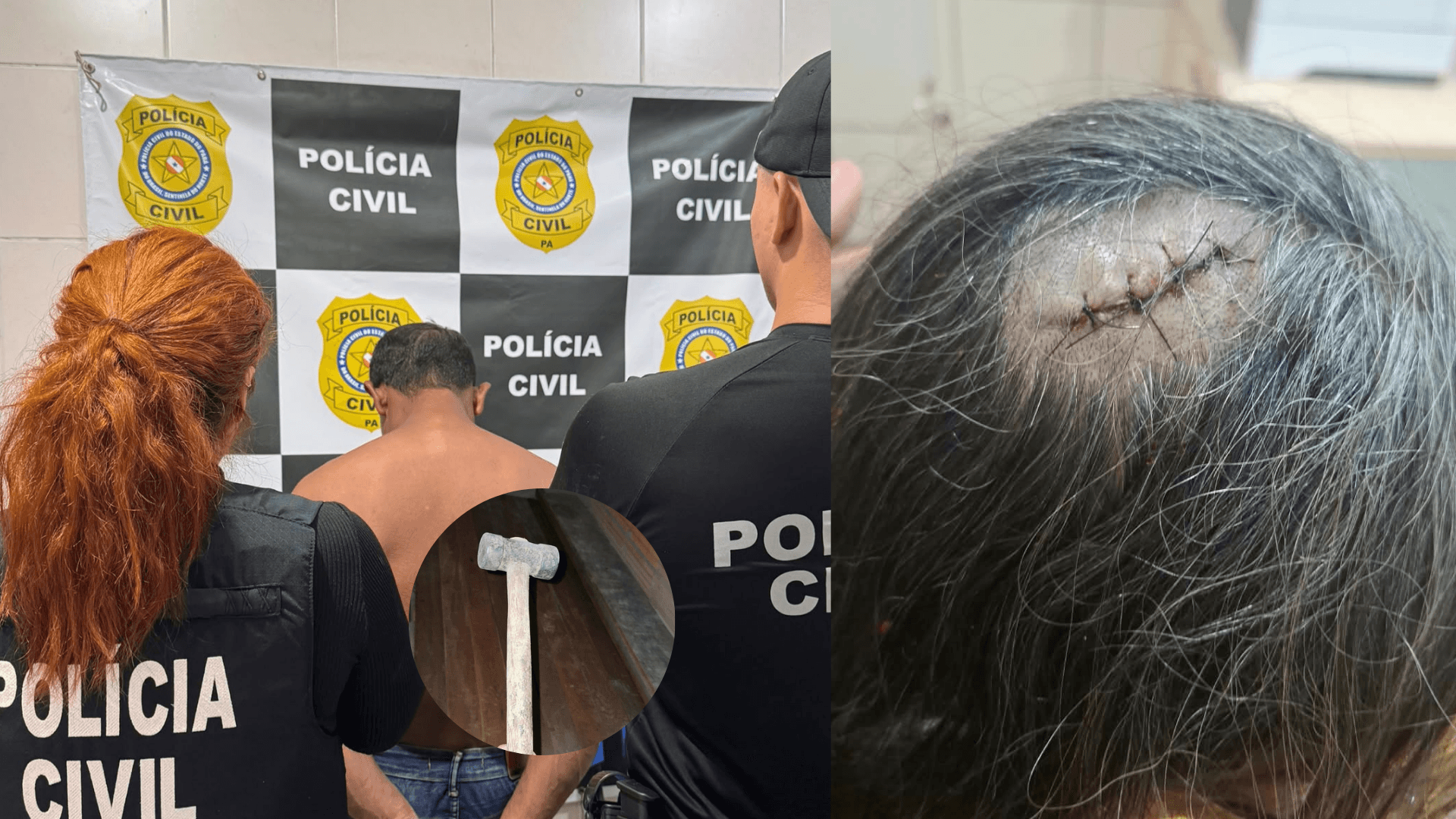 Homem é preso após atacar a própria mãe com marreta em São Miguel do Guamá