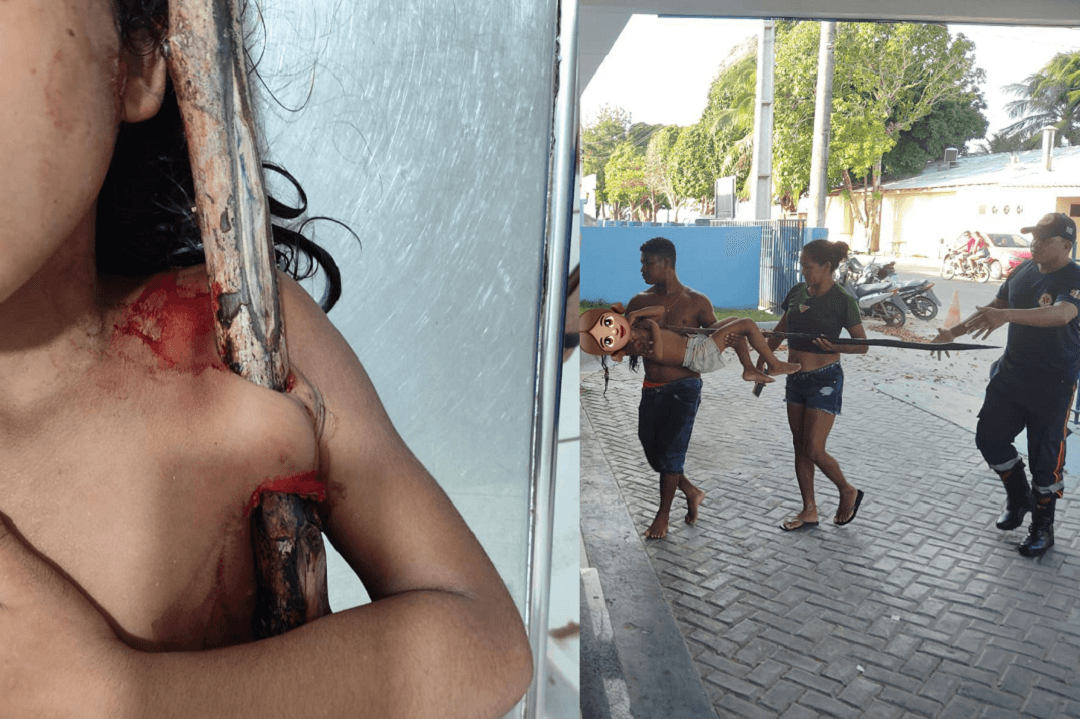 Acidente em rio deixa criança de 7 anos gravemente ferida em Portel