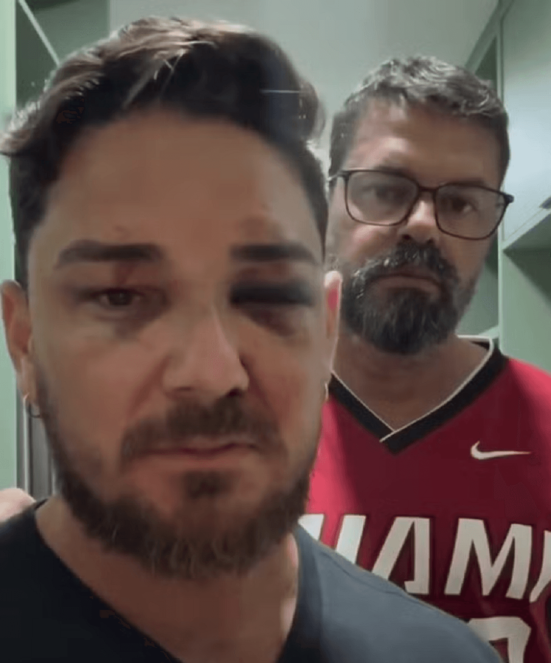 Casal de turistas espancado em Porto de Galinhas afirma que agressões foram motivadas por homofobia