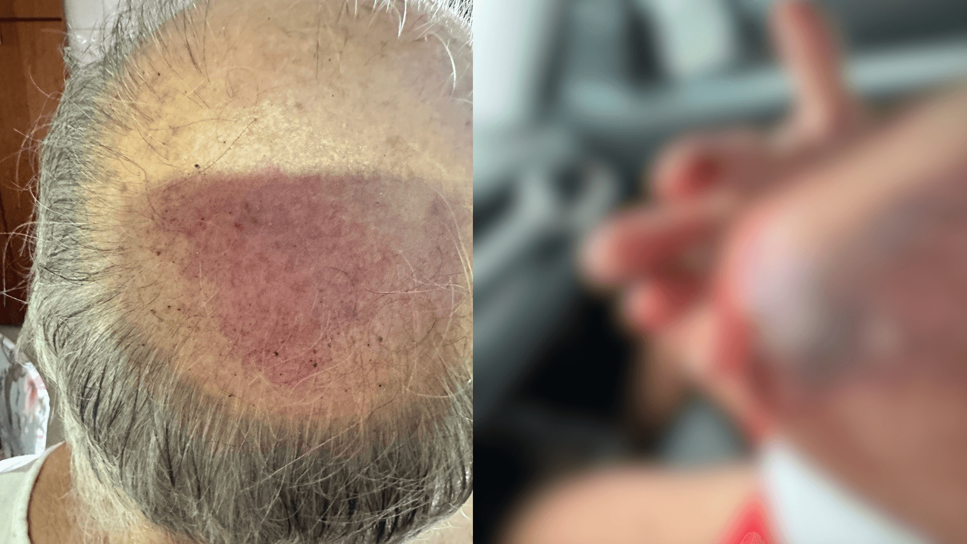Idoso é agredido por batedor da PM na saída da Agrizone