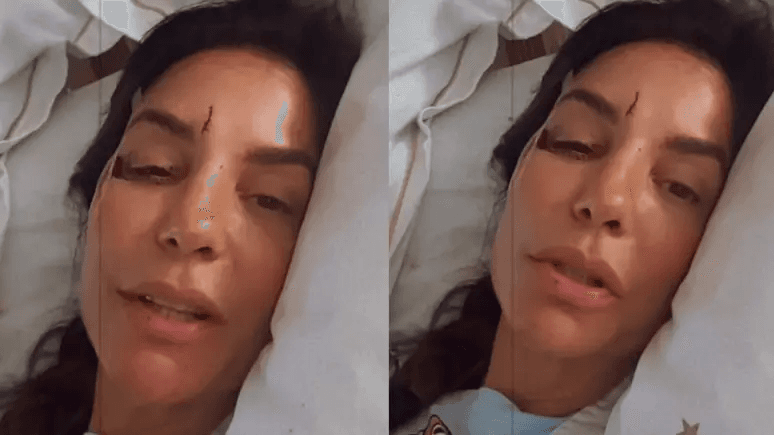 Ivete Sangalo é hospitalizada em Salvador após acidente dentro de casa