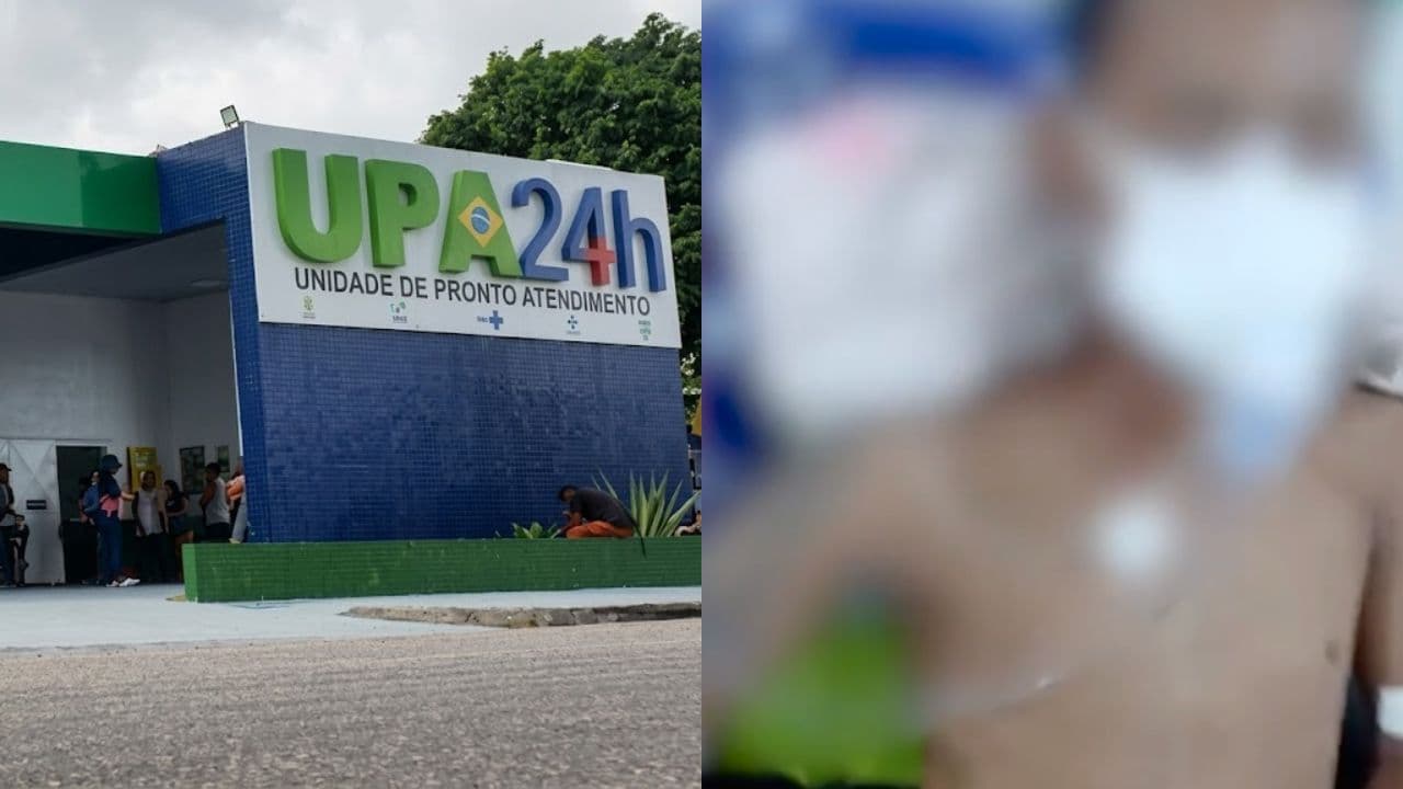 Jovem de 18 anos morre após dias internado com infecção dentária em UPA de Ananindeua enquanto aguardava transferência