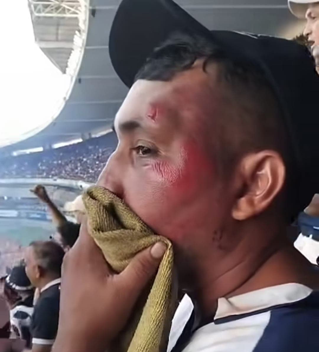 Vídeo: torcedor do Remo sofre acidente e vai à arquibancada com o rosto ferido